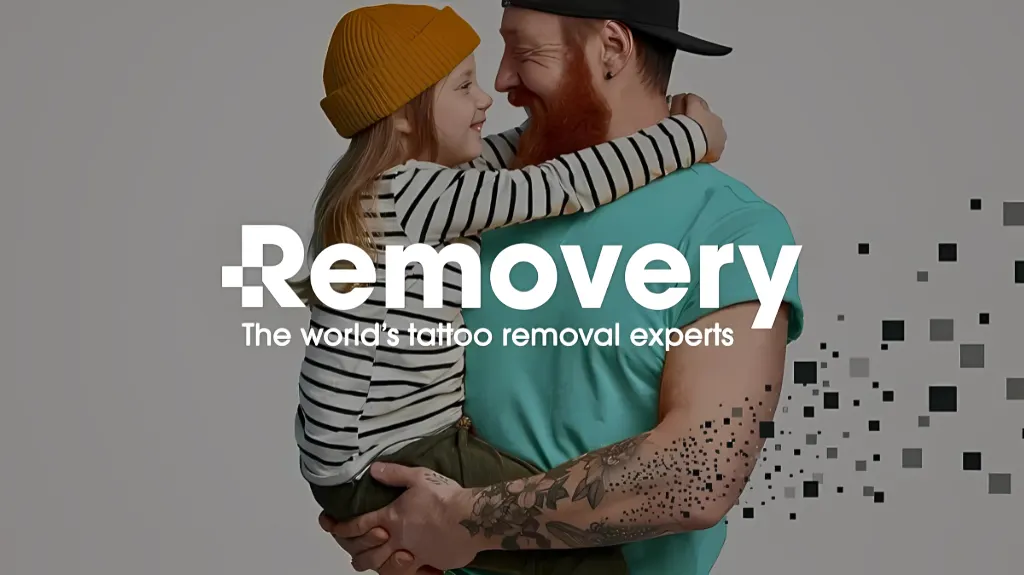 Removery Tattoo Removal & Fading — Tattoo removal service in Shenandoah